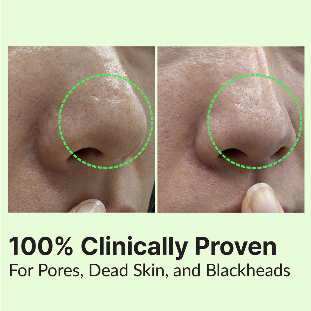 Returnu Pore Shooter Cleansing Balm jar packaging close-up
